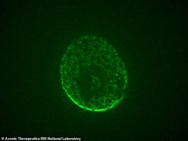 Scientists on the International Space Station (ISS) have grown brain-like organoids in space to research new treatments for Alzheimer's, Parkinson's and spinal injuries