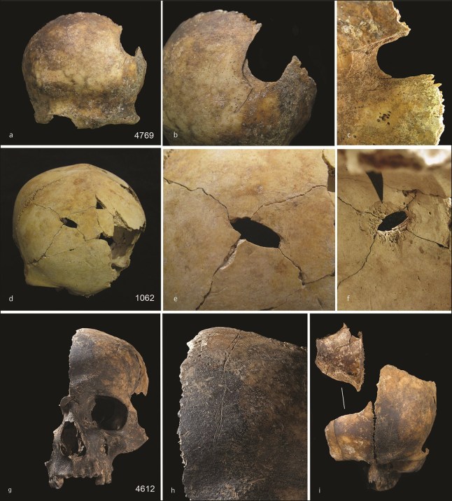 EMB 0001 Cannibals Bronze Age Britons 