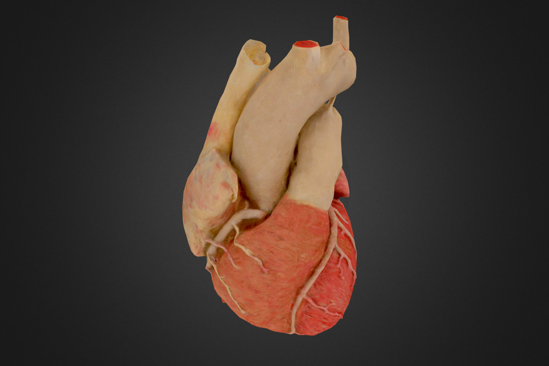 3D immersive model of a heart created by NYU Langone Health.