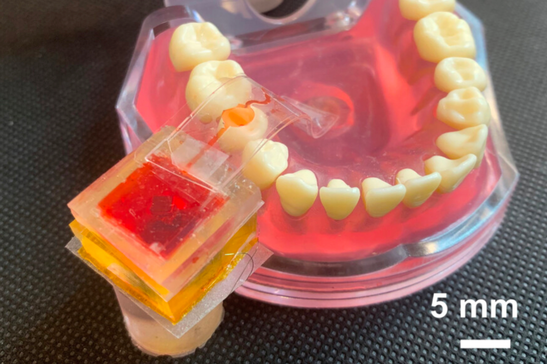 The e-Taste sensor kit inside mouth cavity.