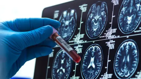 Getty Images A vial of blood in front of a some medical scans